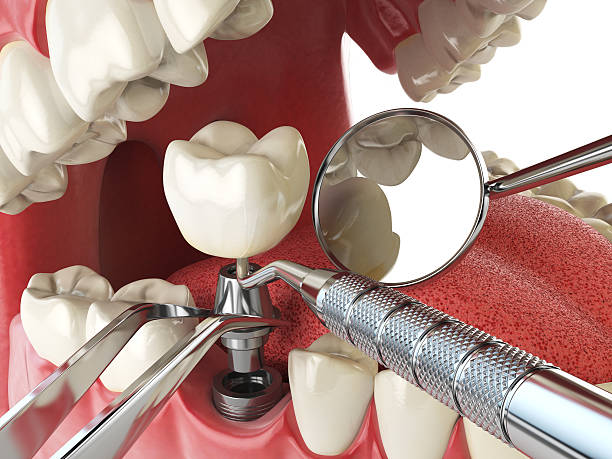 Best Emergency Dental Care for Abscessed Tooth in Caryville, TN